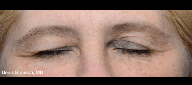 Denis Branson Eyes Before
