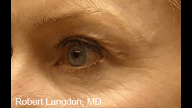 thermismoothface-robert-langdon-before