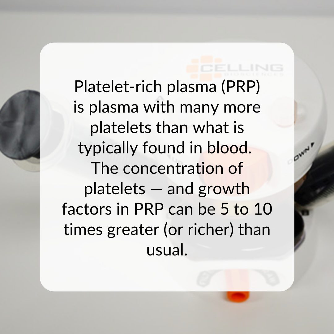 PRP - Platelet-Rich Plasma