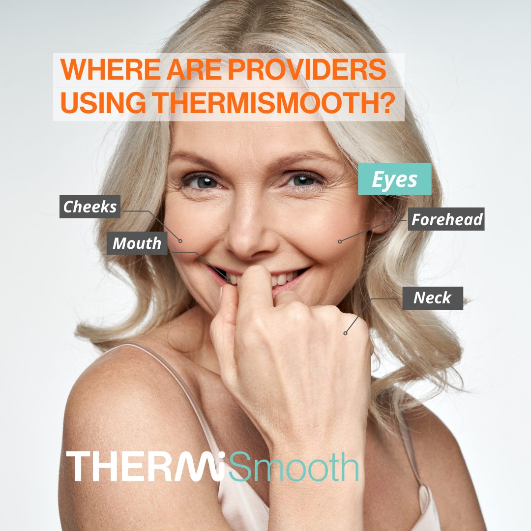 ThermiSmooth Providers Map (Blue)