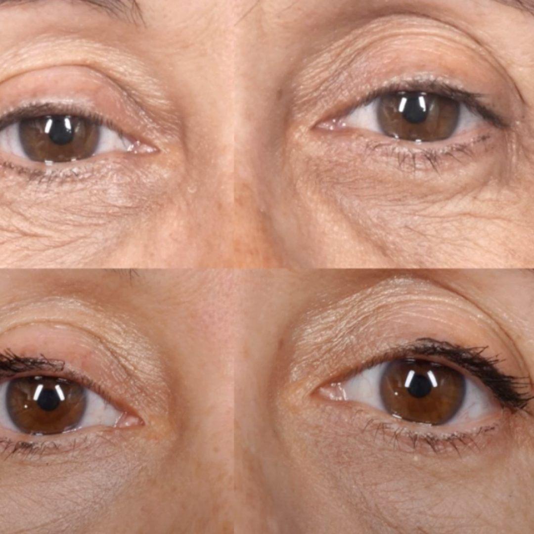 Before Your Appointment